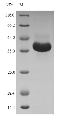 (Tris-Glycine gel) Discontinuous SDS-PAGE (reduced) with 5% enrichment gel and 15% separation gel. (Tris-Glycine gel) Discontinuous SDS-PAGE (reduced) with 5% enrichment gel and 15% separation gel.