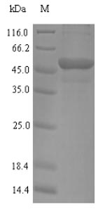 (Tris-Glycine gel) Discontinuous SDS-PAGE (reduced) with 5% enrichment gel and 15% separation gel. (Tris-Glycine gel) Discontinuous SDS-PAGE (reduced) with 5% enrichment gel and 15% separation gel.