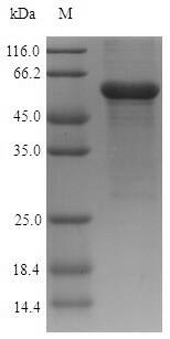 SDS-PAGE- Recombinant protein Human ASAH1