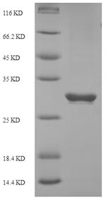 (Tris-Glycine gel) Discontinuous SDS-PAGE (reduced) with 5% enrichment gel and 15% separation gel. (Tris-Glycine gel) Discontinuous SDS-PAGE (reduced) with 5% enrichment gel and 15% separation gel.