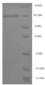 (Tris-Glycine gel) Discontinuous SDS-PAGE (reduced) with 5% enrichment gel and 15% separation gel. (Tris-Glycine gel) Discontinuous SDS-PAGE (reduced) with 5% enrichment gel and 15% separation gel.