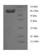 (Tris-Glycine gel) Discontinuous SDS-PAGE (reduced) with 5% enrichment gel and 15% separation gel. (Tris-Glycine gel) Discontinuous SDS-PAGE (reduced) with 5% enrichment gel and 15% separation gel.