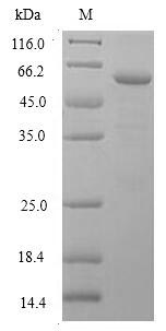 CSB-EP621686HU SDS-PAGE