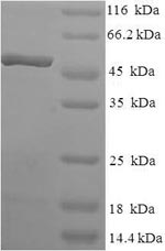(Tris-Glycine gel) Discontinuous SDS-PAGE (reduced) with 5% enrichment gel and 15% separation gel. (Tris-Glycine gel) Discontinuous SDS-PAGE (reduced) with 5% enrichment gel and 15% separation gel.