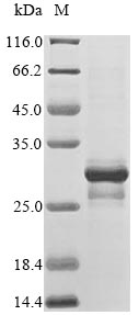 (Tris-Glycine gel) Discontinuous SDS-PAGE (reduced) with 5% enrichment gel and 15% separation gel. (Tris-Glycine gel) Discontinuous SDS-PAGE (reduced) with 5% enrichment gel and 15% separation gel.