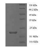 (Tris-Glycine gel) Discontinuous SDS-PAGE (reduced) with 5% enrichment gel and 15% separation gel. (Tris-Glycine gel) Discontinuous SDS-PAGE (reduced) with 5% enrichment gel and 15% separation gel.