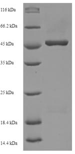 (Tris-Glycine gel) Discontinuous SDS-PAGE (reduced) with 5% enrichment gel and 15% separation gel. (Tris-Glycine gel) Discontinuous SDS-PAGE (reduced) with 5% enrichment gel and 15% separation gel.
