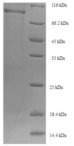 (Tris-Glycine gel) Discontinuous SDS-PAGE (reduced) with 5% enrichment gel and 15% separation gel. (Tris-Glycine gel) Discontinuous SDS-PAGE (reduced) with 5% enrichment gel and 15% separation gel.