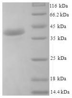 (Tris-Glycine gel) Discontinuous SDS-PAGE (reduced) with 5% enrichment gel and 15% separation gel. (Tris-Glycine gel) Discontinuous SDS-PAGE (reduced) with 5% enrichment gel and 15% separation gel.