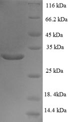 (Tris-Glycine gel) Discontinuous SDS-PAGE (reduced) with 5% enrichment gel and 15% separation gel. (Tris-Glycine gel) Discontinuous SDS-PAGE (reduced) with 5% enrichment gel and 15% separation gel.