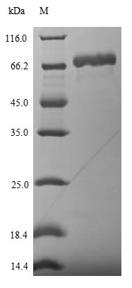 (Tris-Glycine gel) Discontinuous SDS-PAGE (reduced) with 5% enrichment gel and 15% separation gel. (Tris-Glycine gel) Discontinuous SDS-PAGE (reduced) with 5% enrichment gel and 15% separation gel.