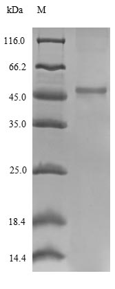 (Tris-Glycine gel) Discontinuous SDS-PAGE (reduced) with 5% enrichment gel and 15% separation gel. (Tris-Glycine gel) Discontinuous SDS-PAGE (reduced) with 5% enrichment gel and 15% separation gel.