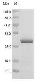 (Tris-Glycine gel) Discontinuous SDS-PAGE (reduced) with 5% enrichment gel and 15% separation gel. (Tris-Glycine gel) Discontinuous SDS-PAGE (reduced) with 5% enrichment gel and 15% separation gel.