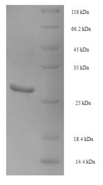 SDS-PAGE- Recombinant protein Pig NGF