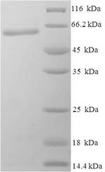 (Tris-Glycine gel) Discontinuous SDS-PAGE (reduced) with 5% enrichment gel and 15% separation gel. (Tris-Glycine gel) Discontinuous SDS-PAGE (reduced) with 5% enrichment gel and 15% separation gel.
