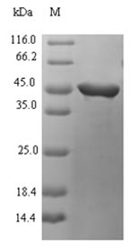 (Tris-Glycine gel) Discontinuous SDS-PAGE (reduced) with 5% enrichment gel and 15% separation gel. (Tris-Glycine gel) Discontinuous SDS-PAGE (reduced) with 5% enrichment gel and 15% separation gel.
