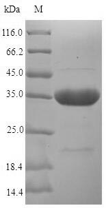 (Tris-Glycine gel) Discontinuous SDS-PAGE (reduced) with 5% enrichment gel and 15% separation gel. (Tris-Glycine gel) Discontinuous SDS-PAGE (reduced) with 5% enrichment gel and 15% separation gel.