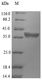 (Tris-Glycine gel) Discontinuous SDS-PAGE (reduced) with 5% enrichment gel and 15% separation gel.