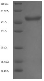 (Tris-Glycine gel) Discontinuous SDS-PAGE (reduced) with 5% enrichment gel and 15% separation gel.