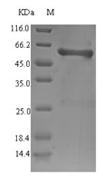 (Tris-Glycine gel) Discontinuous SDS-PAGE (reduced) with 5% enrichment gel and 15% separation gel. (Tris-Glycine gel) Discontinuous SDS-PAGE (reduced) with 5% enrichment gel and 15% separation gel.