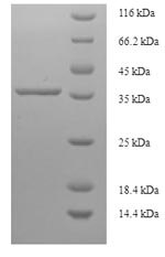 (Tris-Glycine gel) Discontinuous SDS-PAGE (reduced) with 5% enrichment gel and 15% separation gel. (Tris-Glycine gel) Discontinuous SDS-PAGE (reduced) with 5% enrichment gel and 15% separation gel.