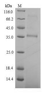 (Tris-Glycine gel) Discontinuous SDS-PAGE (reduced) with 5% enrichment gel and 15% separation gel.