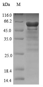 (Tris-Glycine gel) Discontinuous SDS-PAGE (reduced) with 5% enrichment gel and 15% separation gel. (Tris-Glycine gel) Discontinuous SDS-PAGE (reduced) with 5% enrichment gel and 15% separation gel.