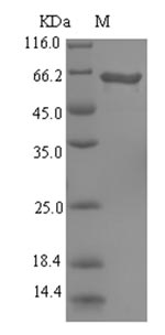 (Tris-Glycine gel) Discontinuous SDS-PAGE (reduced) with 5% enrichment gel and 15% separation gel. (Tris-Glycine gel) Discontinuous SDS-PAGE (reduced) with 5% enrichment gel and 15% separation gel.