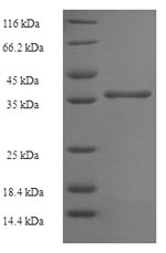 (Tris-Glycine gel) Discontinuous SDS-PAGE (reduced) with 5% enrichment gel and 15% separation gel. (Tris-Glycine gel) Discontinuous SDS-PAGE (reduced) with 5% enrichment gel and 15% separation gel.