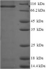 (Tris-Glycine gel) Discontinuous SDS-PAGE (reduced) with 5% enrichment gel and 15% separation gel. (Tris-Glycine gel) Discontinuous SDS-PAGE (reduced) with 5% enrichment gel and 15% separation gel.