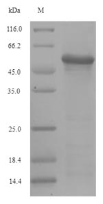 (Tris-Glycine gel) Discontinuous SDS-PAGE (reduced) with 5% enrichment gel and 15% separation gel. (Tris-Glycine gel) Discontinuous SDS-PAGE (reduced) with 5% enrichment gel and 15% separation gel.