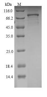 (Tris-Glycine gel) Discontinuous SDS-PAGE (reduced) with 5% enrichment gel and 15% separation gel. (Tris-Glycine gel) Discontinuous SDS-PAGE (reduced) with 5% enrichment gel and 15% separation gel.