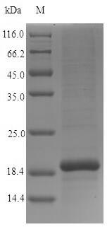 (Tris-Glycine gel) Discontinuous SDS-PAGE (reduced) with 5% enrichment gel and 15% separation gel. (Tris-Glycine gel) Discontinuous SDS-PAGE (reduced) with 5% enrichment gel and 15% separation gel.