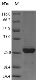 SDS-PAGE- Recombinant protein Giardia gag