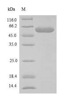 (Tris-Glycine gel) Discontinuous SDS-PAGE (reduced) with 5% enrichment gel and 15% separation gel. (Tris-Glycine gel) Discontinuous SDS-PAGE (reduced) with 5% enrichment gel and 15% separation gel.