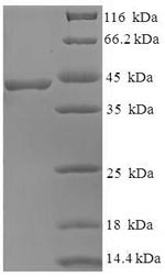 (Tris-Glycine gel) Discontinuous SDS-PAGE (reduced) with 5% enrichment gel and 15% separation gel. (Tris-Glycine gel) Discontinuous SDS-PAGE (reduced) with 5% enrichment gel and 15% separation gel.