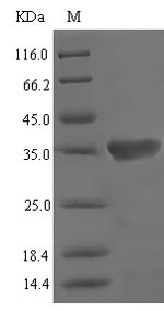 (Tris-Glycine gel) Discontinuous SDS-PAGE (reduced) with 5% enrichment gel and 15% separation gel. (Tris-Glycine gel) Discontinuous SDS-PAGE (reduced) with 5% enrichment gel and 15% separation gel.