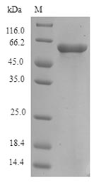(Tris-Glycine gel) Discontinuous SDS-PAGE (reduced) with 5% enrichment gel and 15% separation gel. (Tris-Glycine gel) Discontinuous SDS-PAGE (reduced) with 5% enrichment gel and 15% separation gel.