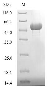(Tris-Glycine gel) Discontinuous SDS-PAGE (reduced) with 5% enrichment gel and 15% separation gel.