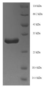 (Tris-Glycine gel) Discontinuous SDS-PAGE (reduced) with 5% enrichment gel and 15% separation gel. (Tris-Glycine gel) Discontinuous SDS-PAGE (reduced) with 5% enrichment gel and 15% separation gel.