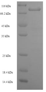 (Tris-Glycine gel) Discontinuous SDS-PAGE (reduced) with 5% enrichment gel and 15% separation gel. (Tris-Glycine gel) Discontinuous SDS-PAGE (reduced) with 5% enrichment gel and 15% separation gel.