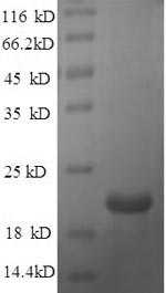(Tris-Glycine gel) Discontinuous SDS-PAGE (reduced) with 5% enrichment gel and 15% separation gel. (Tris-Glycine gel) Discontinuous SDS-PAGE (reduced) with 5% enrichment gel and 15% separation gel.