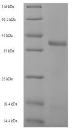 (Tris-Glycine gel) Discontinuous SDS-PAGE (reduced) with 5% enrichment gel and 15% separation gel.