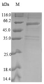 (Tris-Glycine gel) Discontinuous SDS-PAGE (reduced) with 5% enrichment gel and 15% separation gel. (Tris-Glycine gel) Discontinuous SDS-PAGE (reduced) with 5% enrichment gel and 15% separation gel.