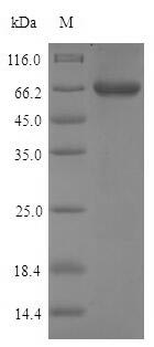 (Tris-Glycine gel) Discontinuous SDS-PAGE (reduced) with 5% enrichment gel and 15% separation gel. (Tris-Glycine gel) Discontinuous SDS-PAGE (reduced) with 5% enrichment gel and 15% separation gel.