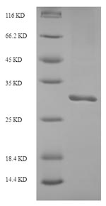 SDS-PAGE- Recombinant protein Human ITIH5