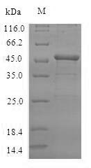 (Tris-Glycine gel) Discontinuous SDS-PAGE (reduced) with 5% enrichment gel and 15% separation gel. (Tris-Glycine gel) Discontinuous SDS-PAGE (reduced) with 5% enrichment gel and 15% separation gel.