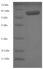 (Tris-Glycine gel) Discontinuous SDS-PAGE (reduced) with 5% enrichment gel and 15% separation gel. (Tris-Glycine gel) Discontinuous SDS-PAGE (reduced) with 5% enrichment gel and 15% separation gel.