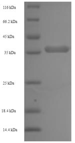(Tris-Glycine gel) Discontinuous SDS-PAGE (reduced) with 5% enrichment gel and 15% separation gel.