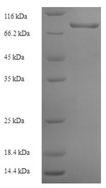 (Tris-Glycine gel) Discontinuous SDS-PAGE (reduced) with 5% enrichment gel and 15% separation gel. (Tris-Glycine gel) Discontinuous SDS-PAGE (reduced) with 5% enrichment gel and 15% separation gel.